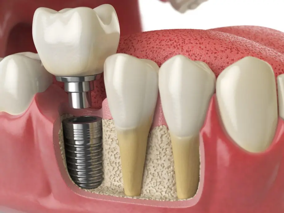 Operate Now: Dental Surgery Walkthrough